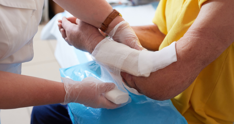 doctor puts a plaster on the arm of a patient in the hospital with a broken arm